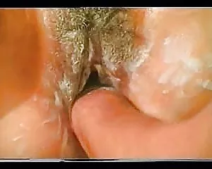 Anal fisting